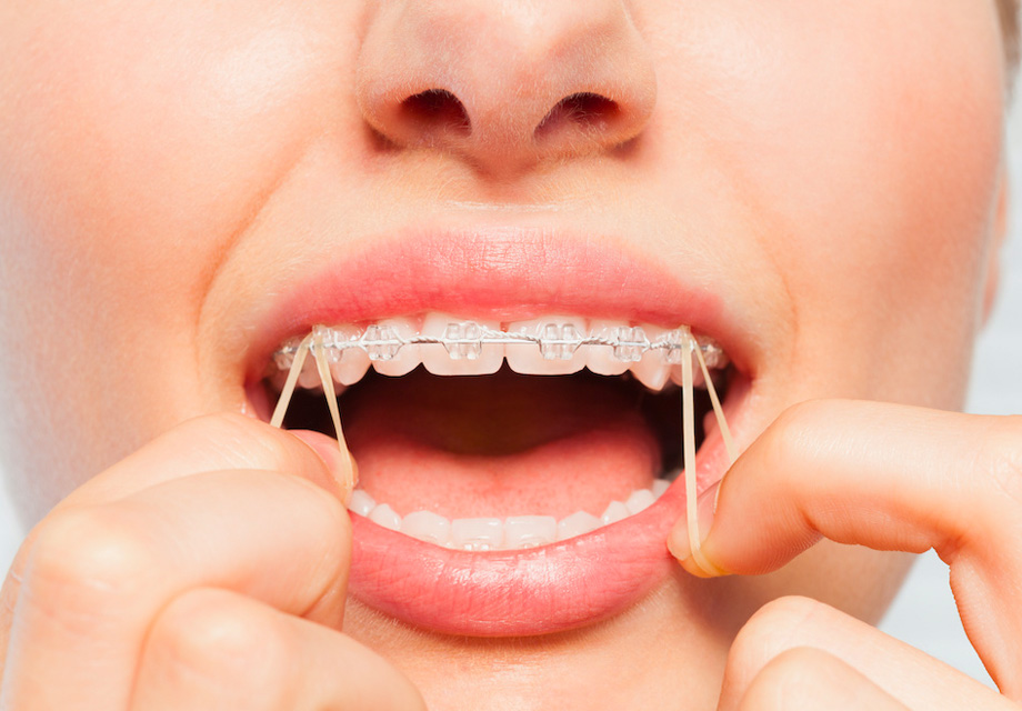 Elastics