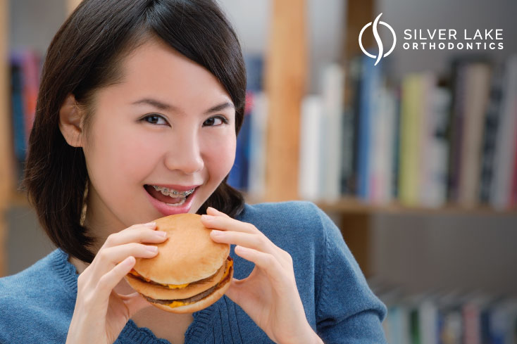Braces and healthy and delicious foods are not mutually exclusive.