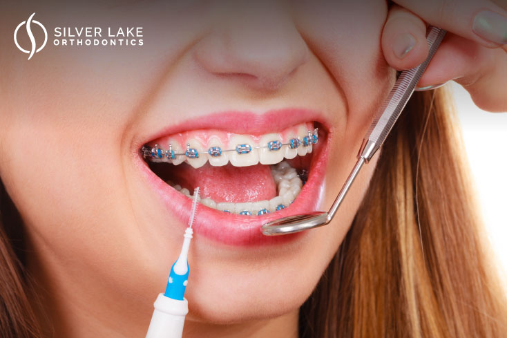Periodontal disease in Everett